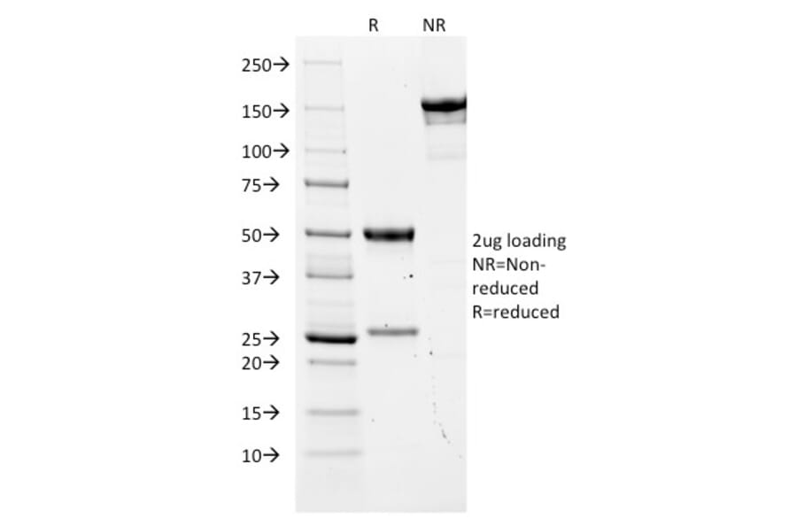 SDS-PAGE - Anti-Carcinoembryonic Antigen Antibody [COL-1] (A248126) - Antibodies.com