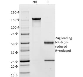 SDS-PAGE - Anti-Carcinoembryonic Antigen Antibody [C66/195] (A248128) - Antibodies.com