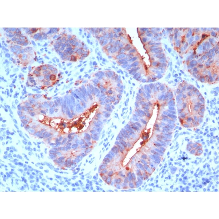 Immunohistochemistry - Anti-Carcinoembryonic Antigen Antibody [C66/195] (A248127) - Antibodies.com