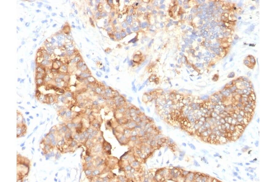 Immunohistochemistry - Anti-Carcinoembryonic Antigen Antibody [SPM330] (A248128) - Antibodies.com