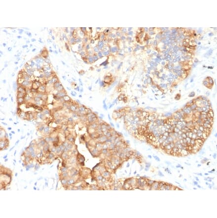 Immunohistochemistry - Anti-Carcinoembryonic Antigen Antibody [SPM330] (A248128) - Antibodies.com
