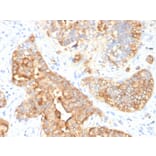 Immunohistochemistry - Anti-Carcinoembryonic Antigen Antibody [SPM330] (A248128) - Antibodies.com