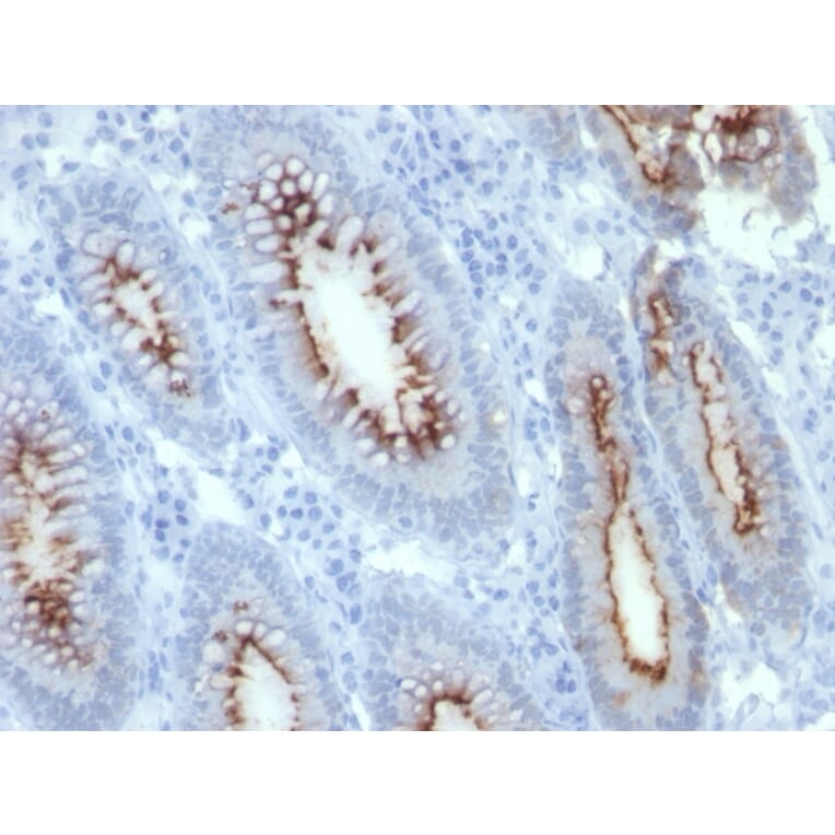Immunohistochemistry - Anti-Carcinoembryonic Antigen Antibody [C66/261] (A248130) - Antibodies.com