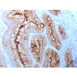 Immunohistochemistry - Anti-Carcinoembryonic Antigen Antibody [C66/261] (A248129) - Antibodies.com