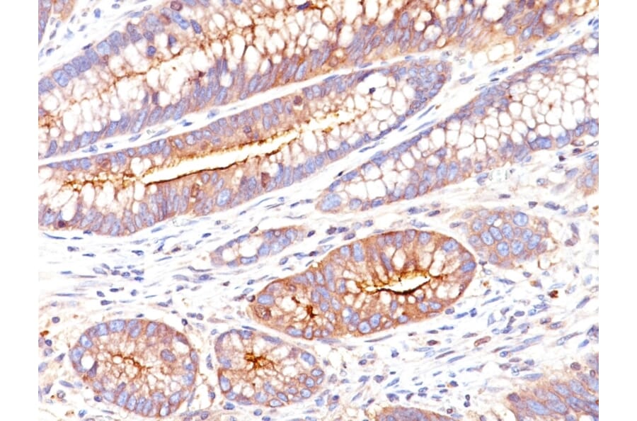 Immunohistochemistry - Anti-Carcinoembryonic Antigen Antibody [SPM551] (A248130) - Antibodies.com