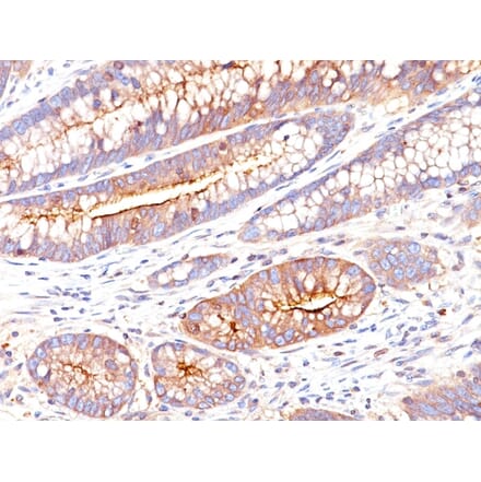 Immunohistochemistry - Anti-Carcinoembryonic Antigen Antibody [SPM551] (A248130) - Antibodies.com