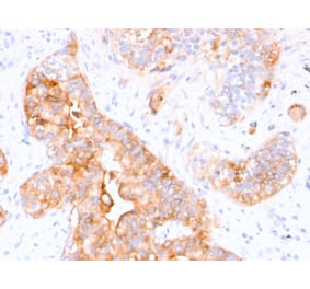 Immunohistochemistry - Anti-Carcinoembryonic Antigen Antibody [CEA31] (A248132) - Antibodies.com