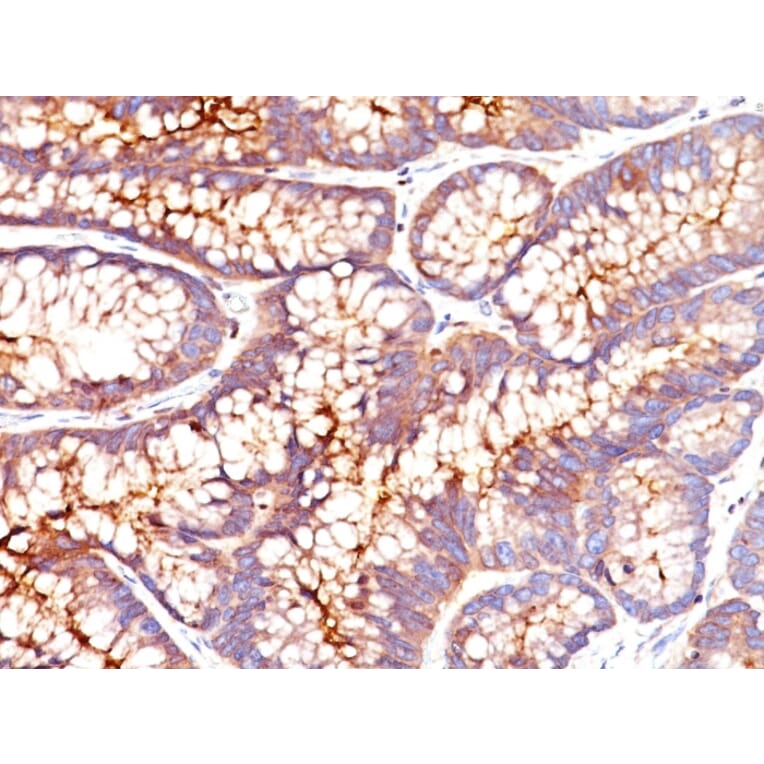Immunohistochemistry - Anti-Carcinoembryonic Antigen Antibody [SPM541] (A248132) - Antibodies.com