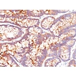 Immunohistochemistry - Anti-Carcinoembryonic Antigen Antibody [SPM541] (A248132) - Antibodies.com