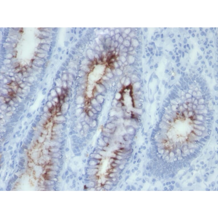 Immunohistochemistry - Anti-Carcinoembryonic Antigen Antibody [SPM506] (A248133) - Antibodies.com