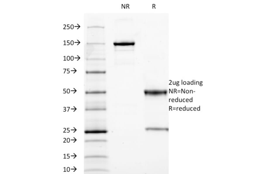 SDS-PAGE - Anti-Carcinoembryonic Antigen Antibody [C66/1009] (A248135) - Antibodies.com