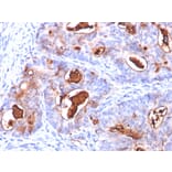 Immunohistochemistry - Anti-Carcinoembryonic Antigen Antibody [COL-1 + CEA31 + C66/261] (A248135) - Antibodies.com
