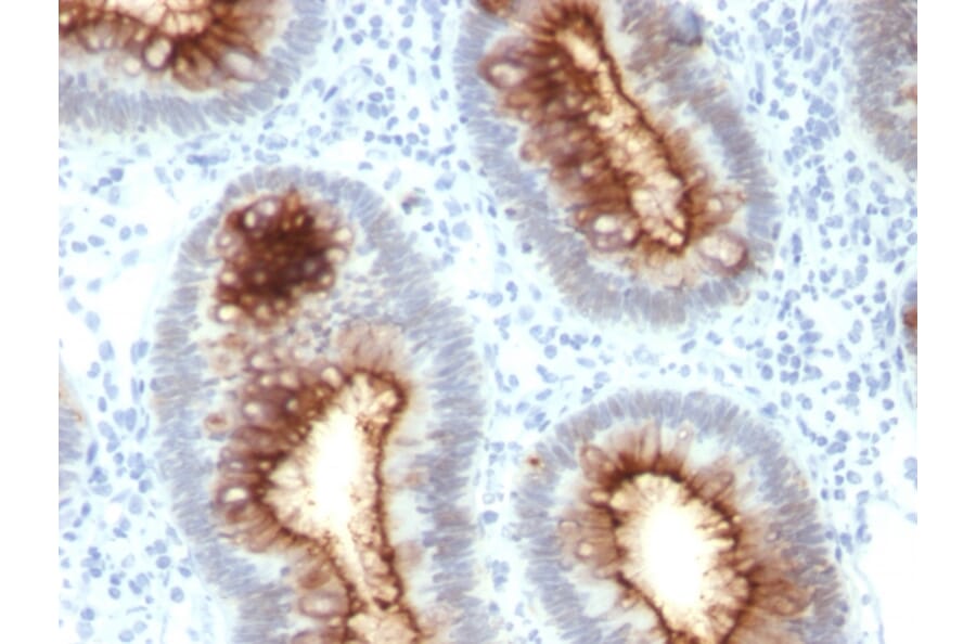 Immunohistochemistry - Anti-Carcinoembryonic Antigen Antibody [C66/1030] (A248136) - Antibodies.com