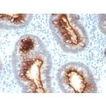 Immunohistochemistry - Anti-Carcinoembryonic Antigen Antibody [C66/1030] (A248136) - Antibodies.com