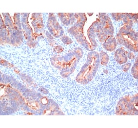 Immunohistochemistry - Anti-Carcinoembryonic Antigen Antibody [Cocktail PAN-CEA] (A248137) - Antibodies.com