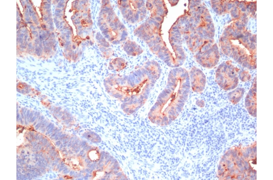 Immunohistochemistry - Anti-Carcinoembryonic Antigen Antibody [Cocktail PAN-CEA] (A248137) - Antibodies.com