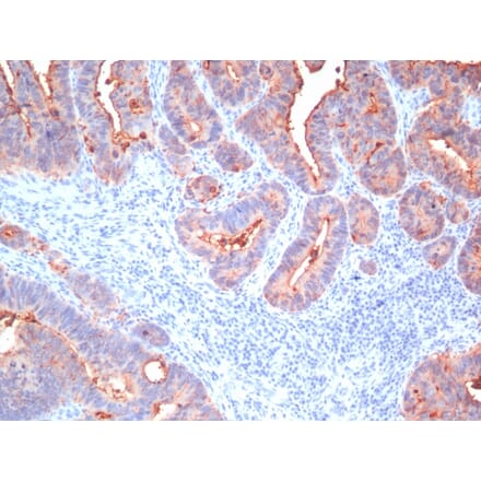Immunohistochemistry - Anti-Carcinoembryonic Antigen Antibody [Cocktail PAN-CEA] (A248137) - Antibodies.com