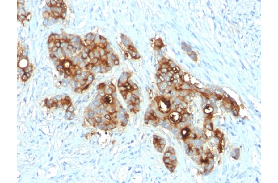 Immunohistochemistry - Anti-Carcinoembryonic Antigen Antibody [C66/2055R] (A248139) - Antibodies.com