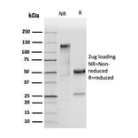 SDS-PAGE - Anti-Carcinoembryonic Antigen Antibody [C66/2055R] (A248140) - Antibodies.com