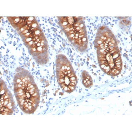 Immunohistochemistry - Anti-Carcinoembryonic Antigen Antibody [C66/3707R] (A248141) - Antibodies.com