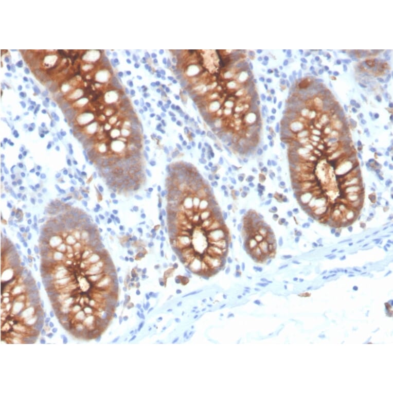 Immunohistochemistry - Anti-Carcinoembryonic Antigen Antibody [C66/3707R] (A248141) - Antibodies.com