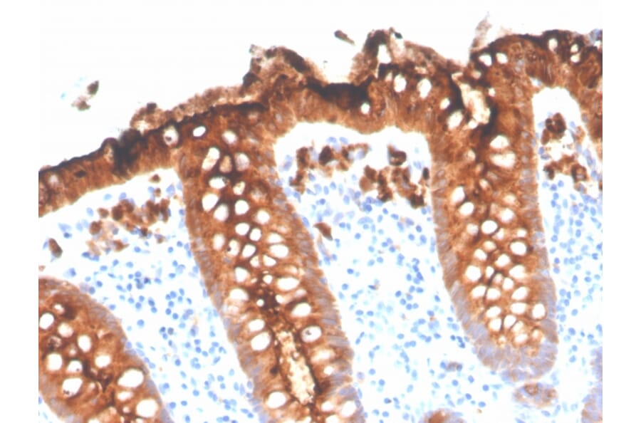 Immunohistochemistry - Anti-Carcinoembryonic Antigen Antibody [C66/3707R] (A248140) - Antibodies.com
