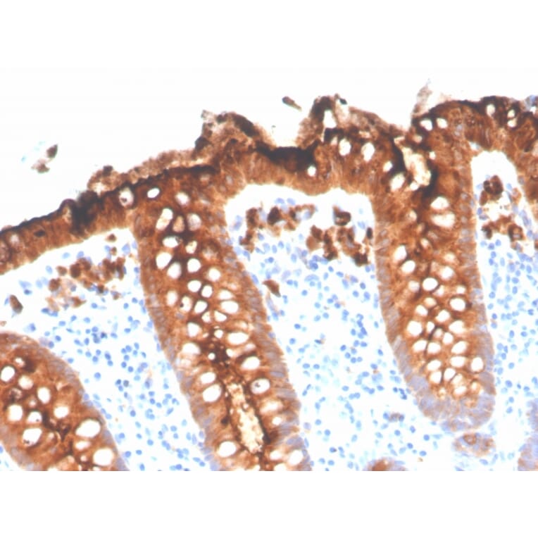 Immunohistochemistry - Anti-Carcinoembryonic Antigen Antibody [C66/3707R] (A248140) - Antibodies.com
