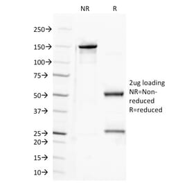 SDS-PAGE - Anti-Semaphorin 4D Antibody [A8] (A248143) - Antibodies.com