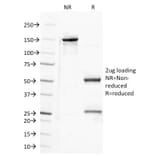 SDS-PAGE - Anti-Semaphorin 4D Antibody [A8] (A248143) - Antibodies.com