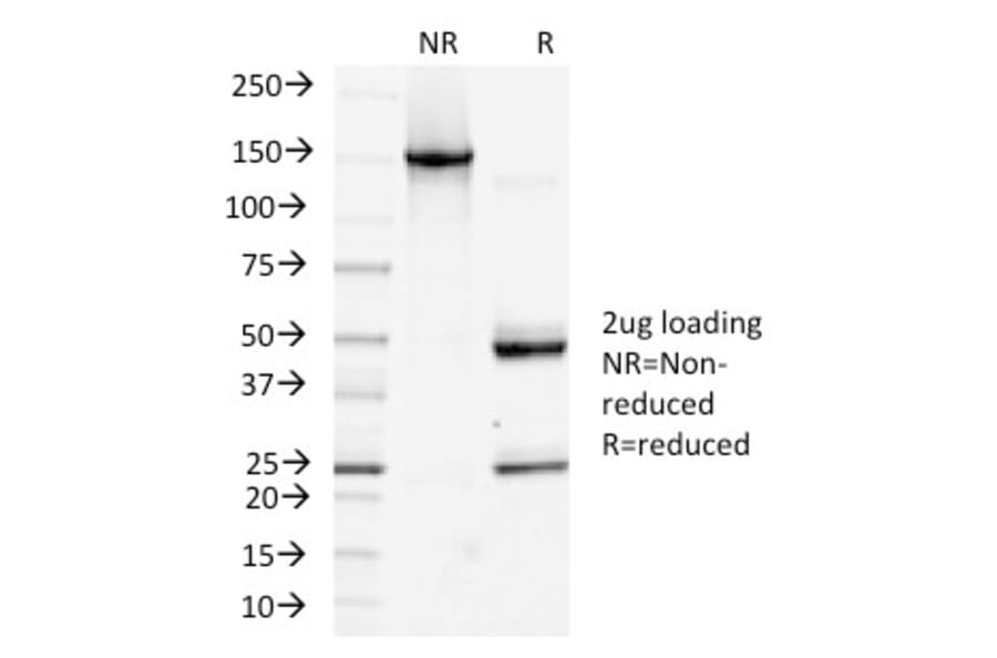 SDS-PAGE - Anti-Podocalyxin Antibody [PDPN/1433] (A248148) - Antibodies.com