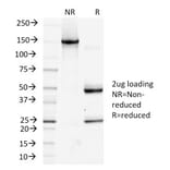 SDS-PAGE - Anti-Podocalyxin Antibody [PDPN/1433] (A248148) - Antibodies.com