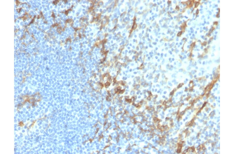 Immunohistochemistry - Anti-Podocalyxin Antibody [PDPN/4009R] (A248149) - Antibodies.com