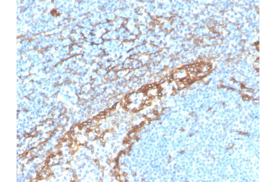 Immunohistochemistry - Anti-Podocalyxin Antibody [PDPN/4009R] (A248148) - Antibodies.com