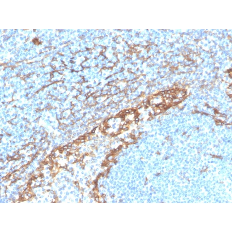 Immunohistochemistry - Anti-Podocalyxin Antibody [PDPN/4009R] (A248148) - Antibodies.com