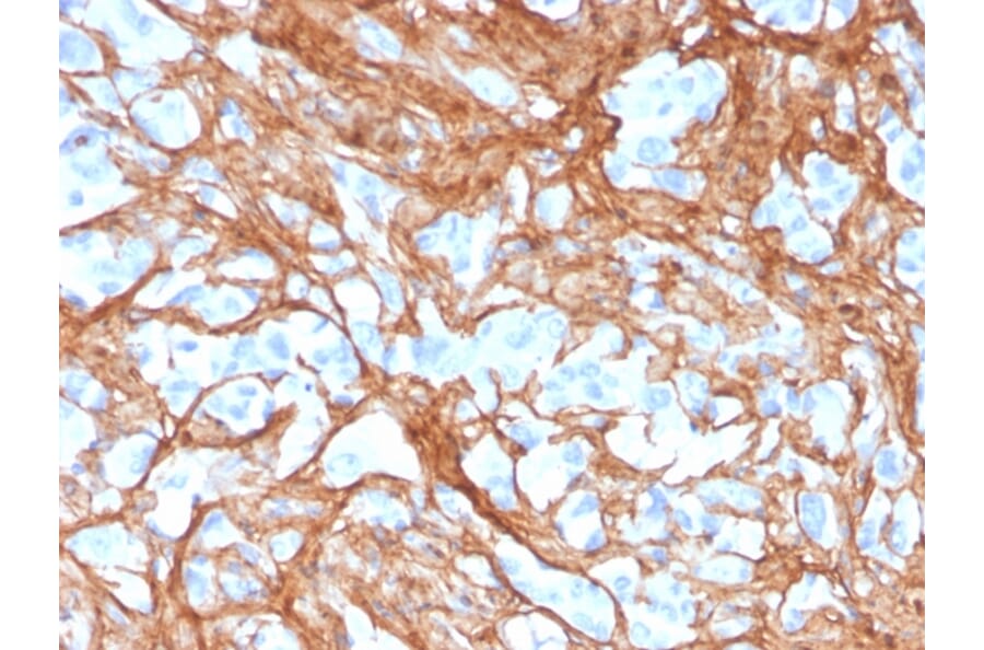 Immunohistochemistry - Anti-Periostin Antibody [POSTN/3501] (A248150) - Antibodies.com