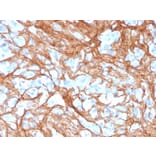 Immunohistochemistry - Anti-Periostin Antibody [POSTN/3501] (A248150) - Antibodies.com
