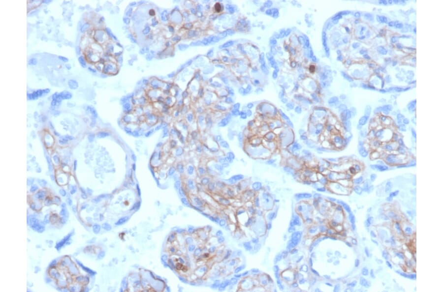 Immunohistochemistry - Anti-Periostin Antibody [POSTN/3501] (A248150) - Antibodies.com