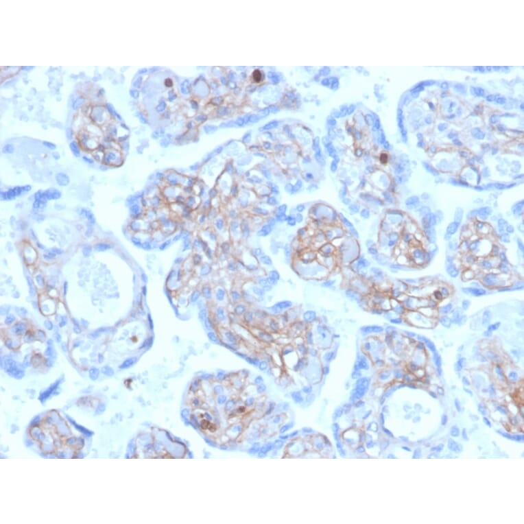 Immunohistochemistry - Anti-Periostin Antibody [POSTN/3501] (A248150) - Antibodies.com
