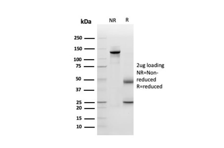 SDS-PAGE - Anti-Periostin Antibody [POSTN/3501] (A248150) - Antibodies.com