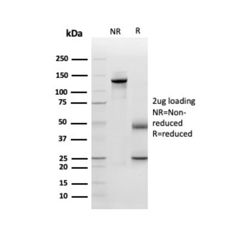SDS-PAGE - Anti-Periostin Antibody [POSTN/3501] (A248150) - Antibodies.com