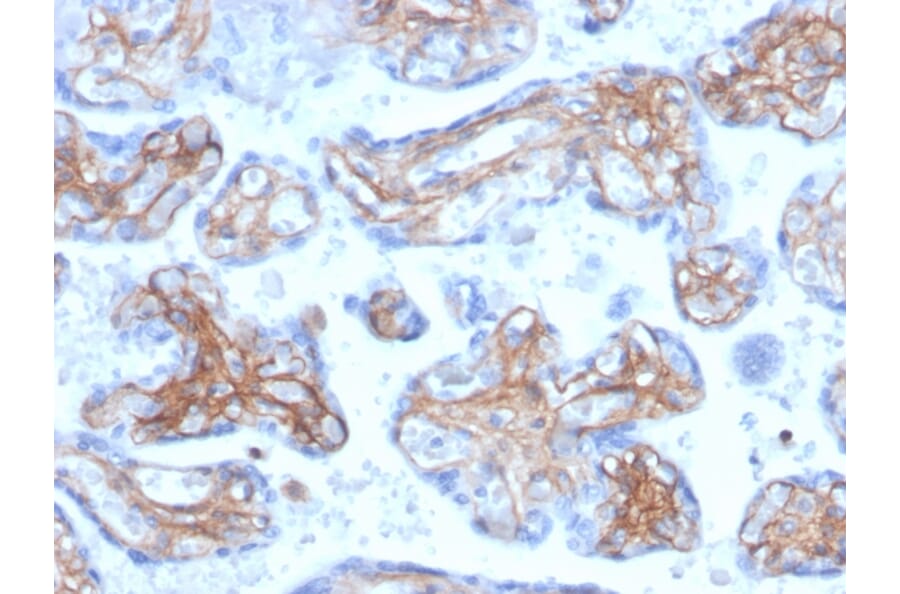 Immunohistochemistry - Anti-Periostin Antibody [POSTN/3503] (A248151) - Antibodies.com