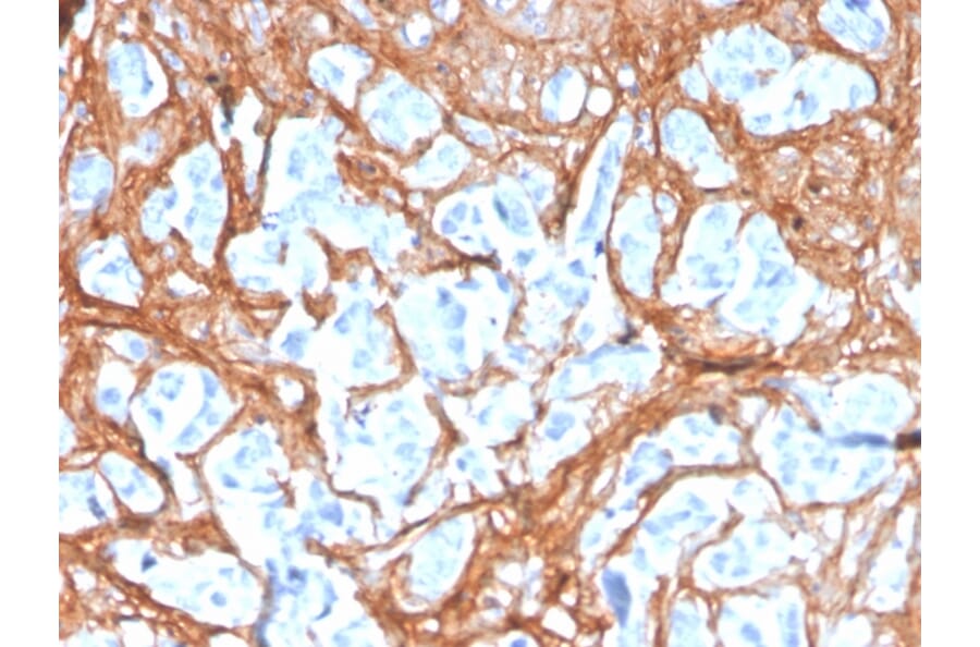 Immunohistochemistry - Anti-Periostin Antibody [POSTN/3503] (A248151) - Antibodies.com