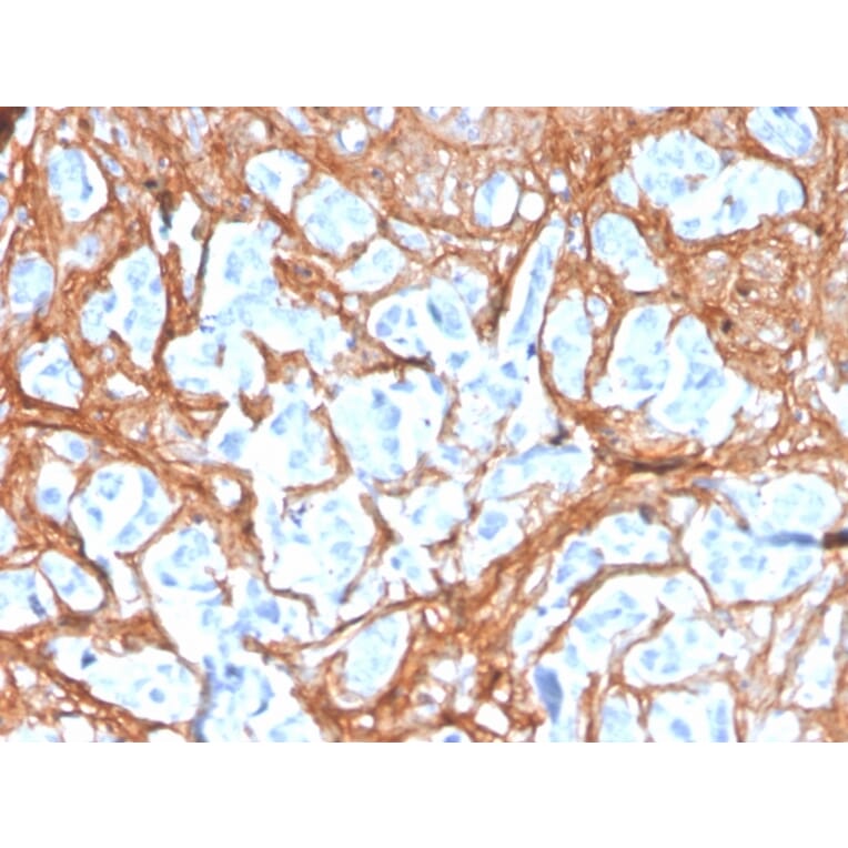 Immunohistochemistry - Anti-Periostin Antibody [POSTN/3503] (A248151) - Antibodies.com