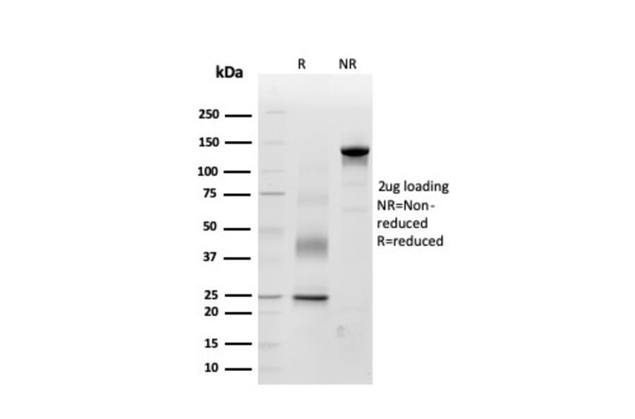 SDS-PAGE - Anti-Periostin Antibody [POSTN/3503] (A248151) - Antibodies.com