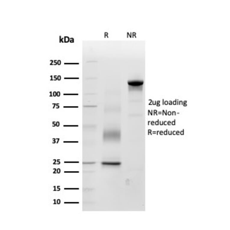 SDS-PAGE - Anti-Periostin Antibody [POSTN/3503] (A248151) - Antibodies.com