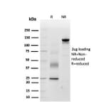 SDS-PAGE - Anti-Periostin Antibody [POSTN/3503] (A248151) - Antibodies.com