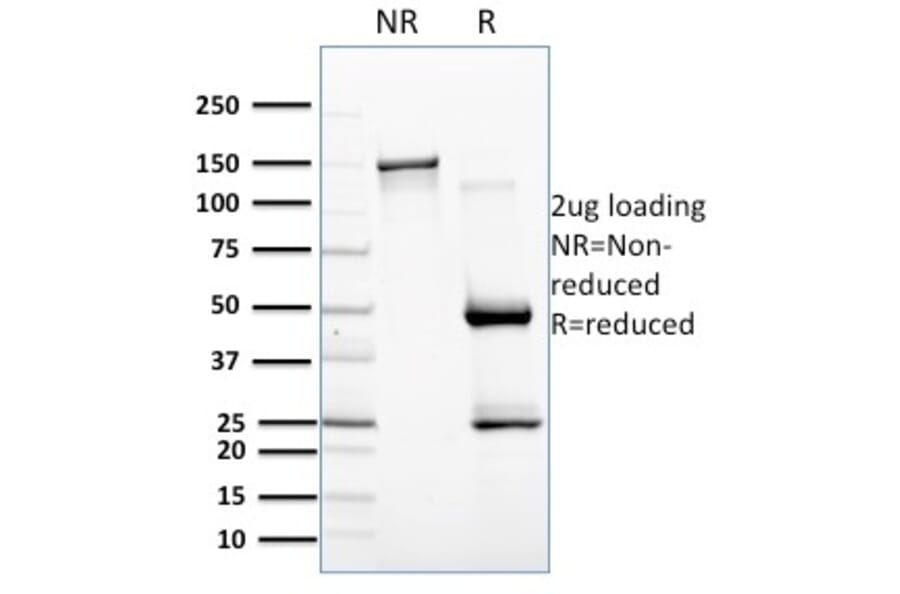 SDS-PAGE - Anti-BAFF Antibody [C257/1638] (A248151) - Antibodies.com
