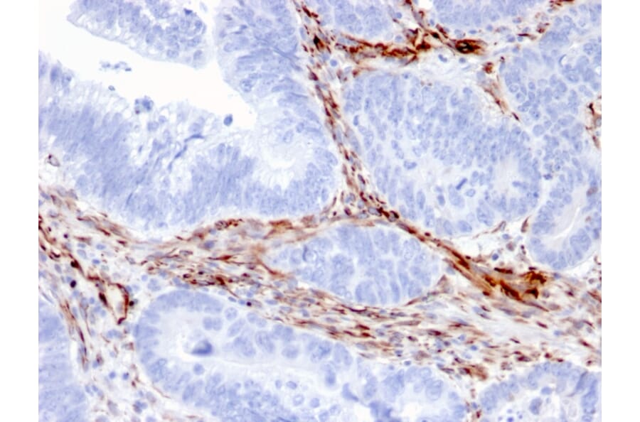 Immunohistochemistry - Anti-Nestin Antibody [NES/2911] (A248153) - Antibodies.com