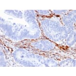 Immunohistochemistry - Anti-Nestin Antibody [NES/2911] (A248153) - Antibodies.com