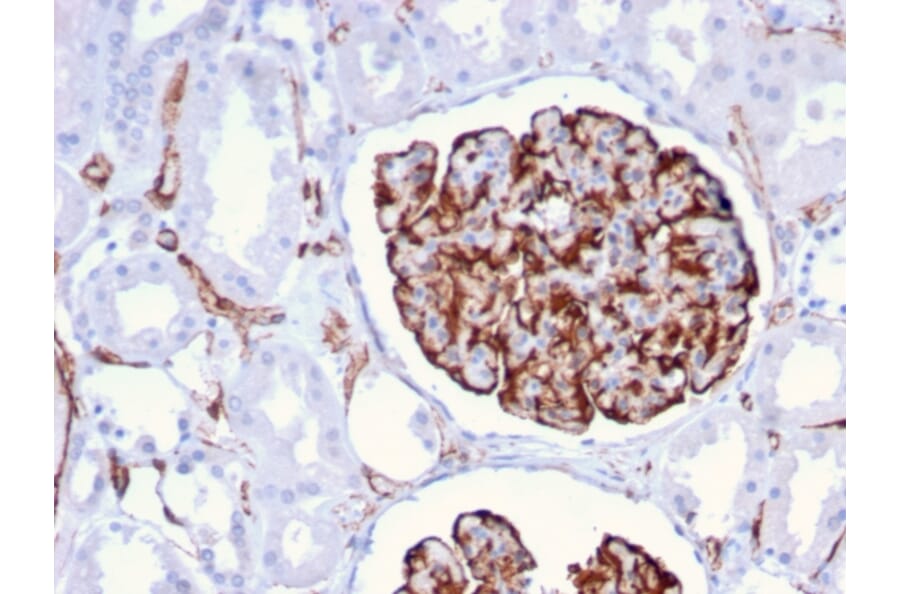 Immunohistochemistry - Anti-Nestin Antibody [NES/2911] (A248153) - Antibodies.com